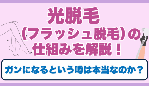 光脱毛(フラッシュ脱毛)の仕組みを解説