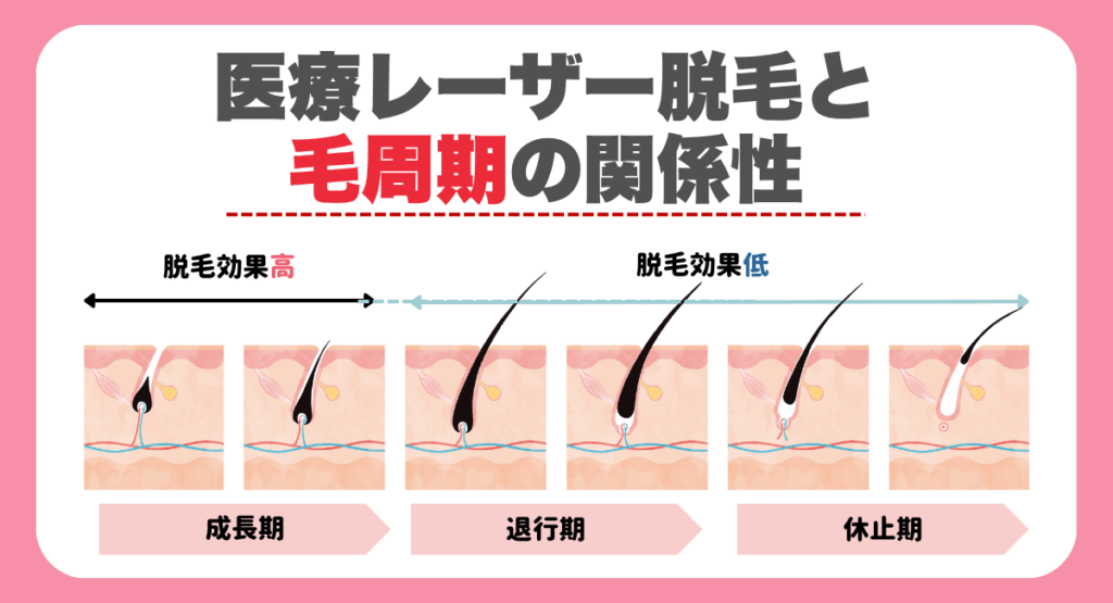 医療レーザー脱毛と毛周期の関係性とは？効率よく脱毛を進める方法