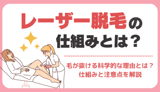 レーザー脱毛の仕組みとは