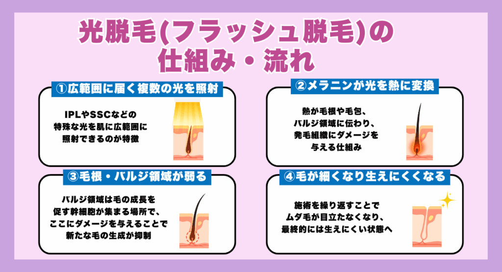 光脱毛（フラッシュ脱毛）の仕組み・流れ